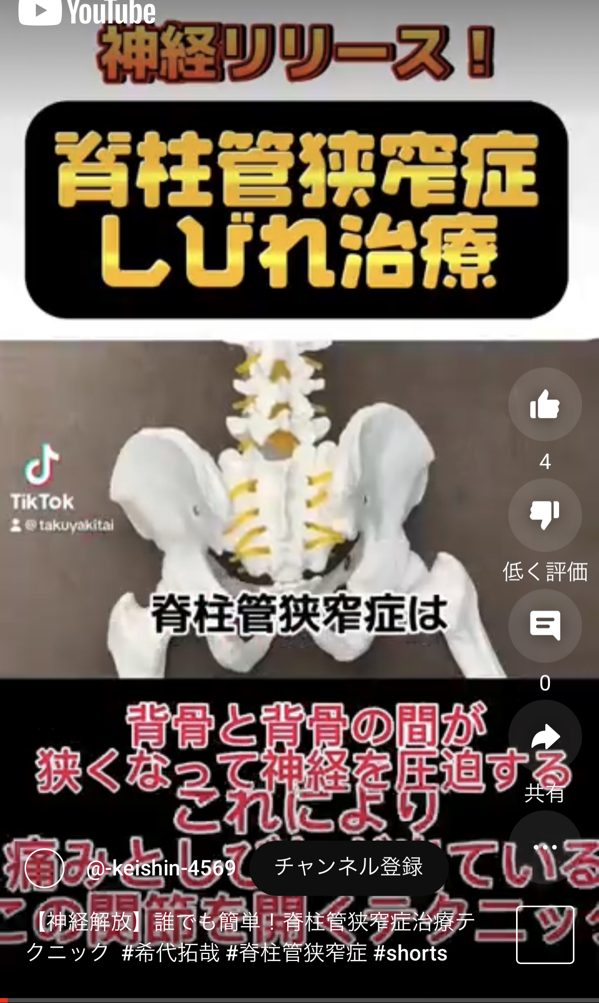 【神経解放】誰でも簡単!脊柱管狭窄症治療テクニック