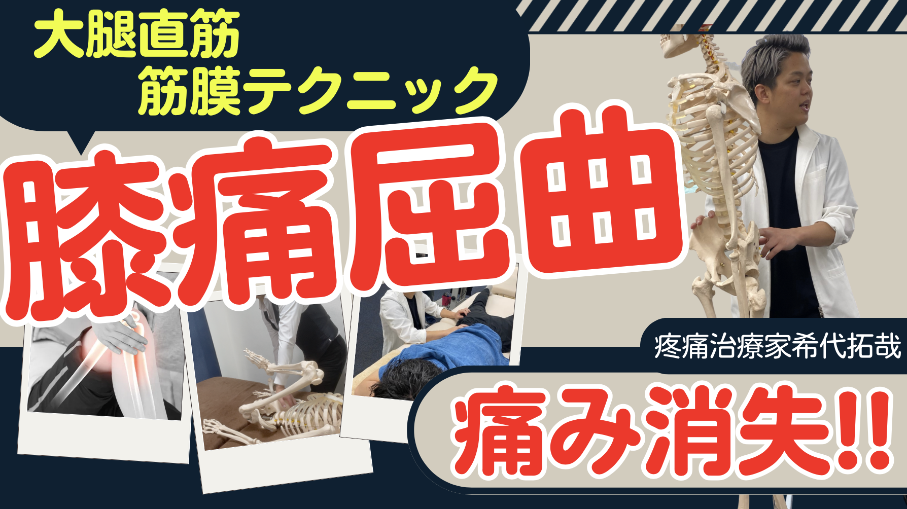 【最終奥義】膝屈曲時の痛みを完全の消失させる!大腿直筋2種類のテクニック公開