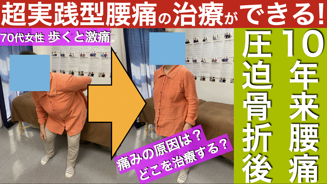 【超実践】見るだけ治せる治療家になれる！圧迫骨折後の10年来の腰痛にはこれをやれ！