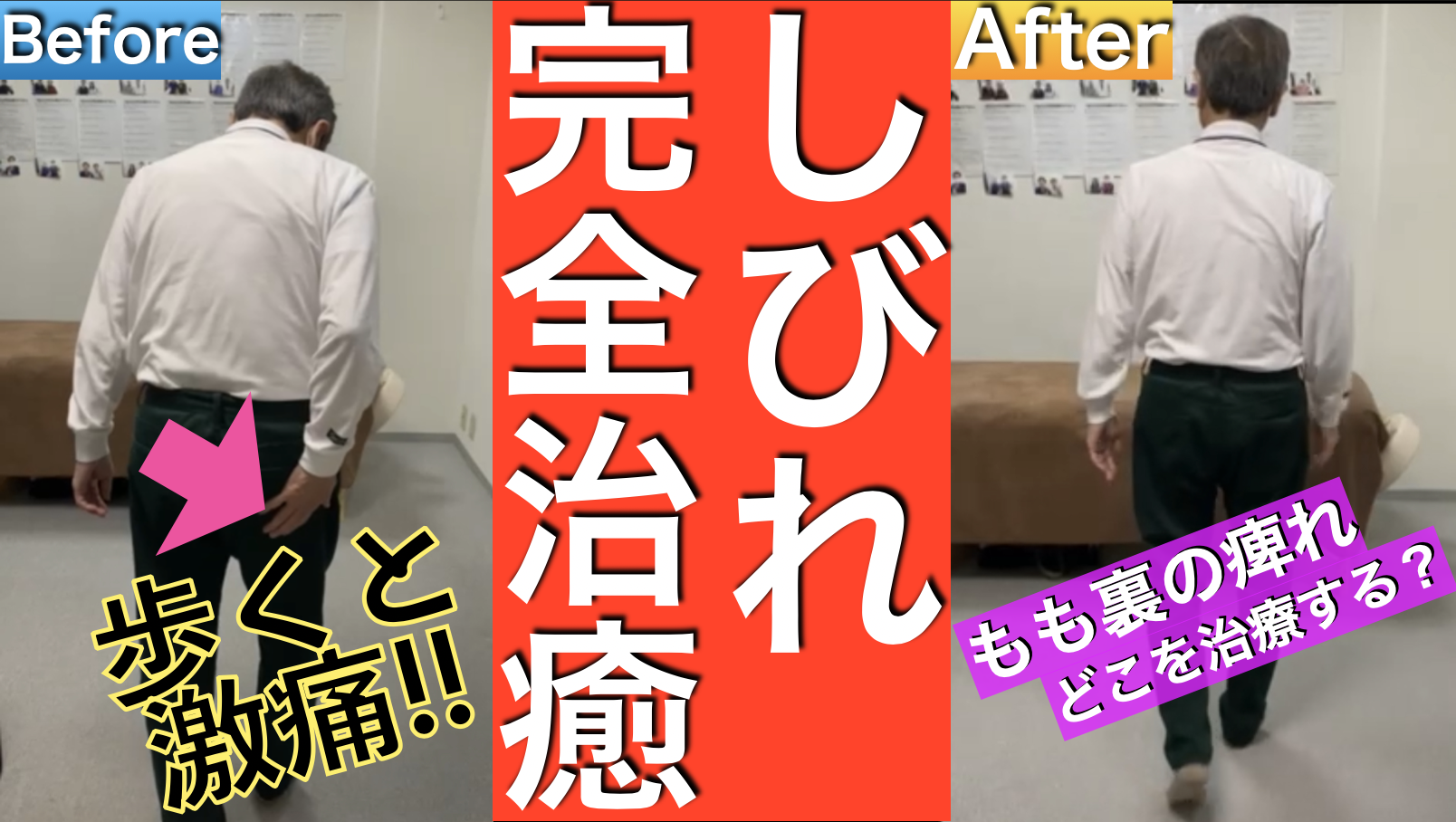 【見て治せ!】超実践型のしびれ治療を徹底解説!もも裏の痺れをゼロにさせる坐骨神経痛治療