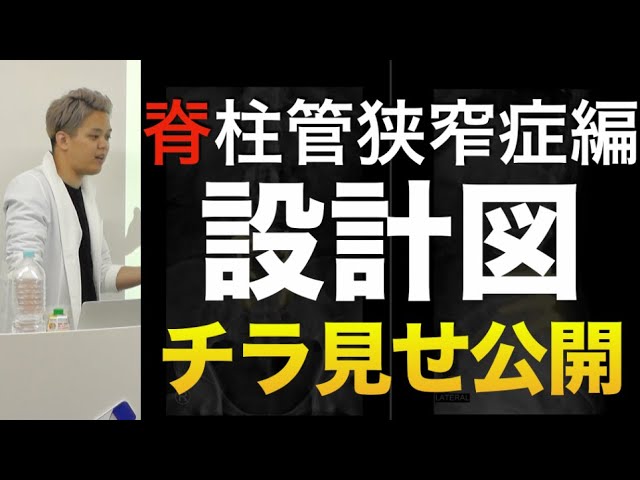 【チラ見せ】月商802万治療院が使う脊柱管狭窄症治療の設計図