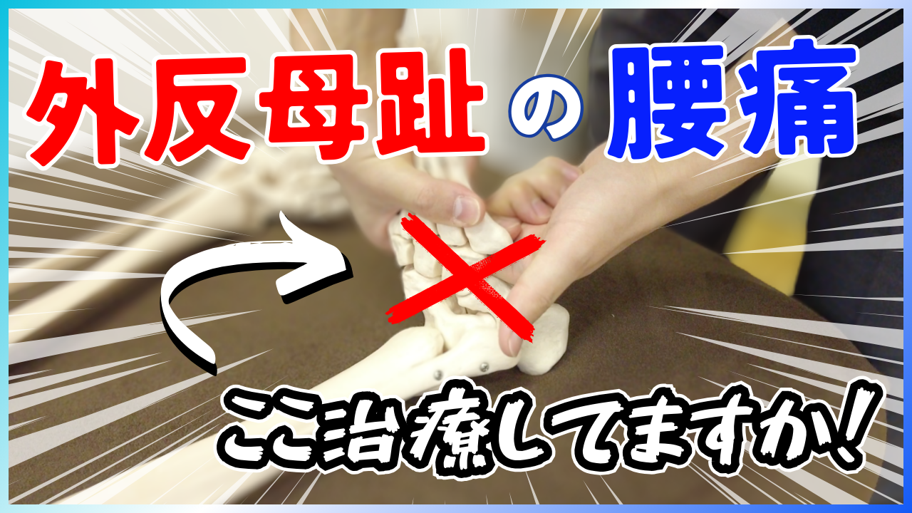 【大好評】外反母趾の治療戦略!特別に 様々な問題を起こす立方骨の治療テクニック教えます