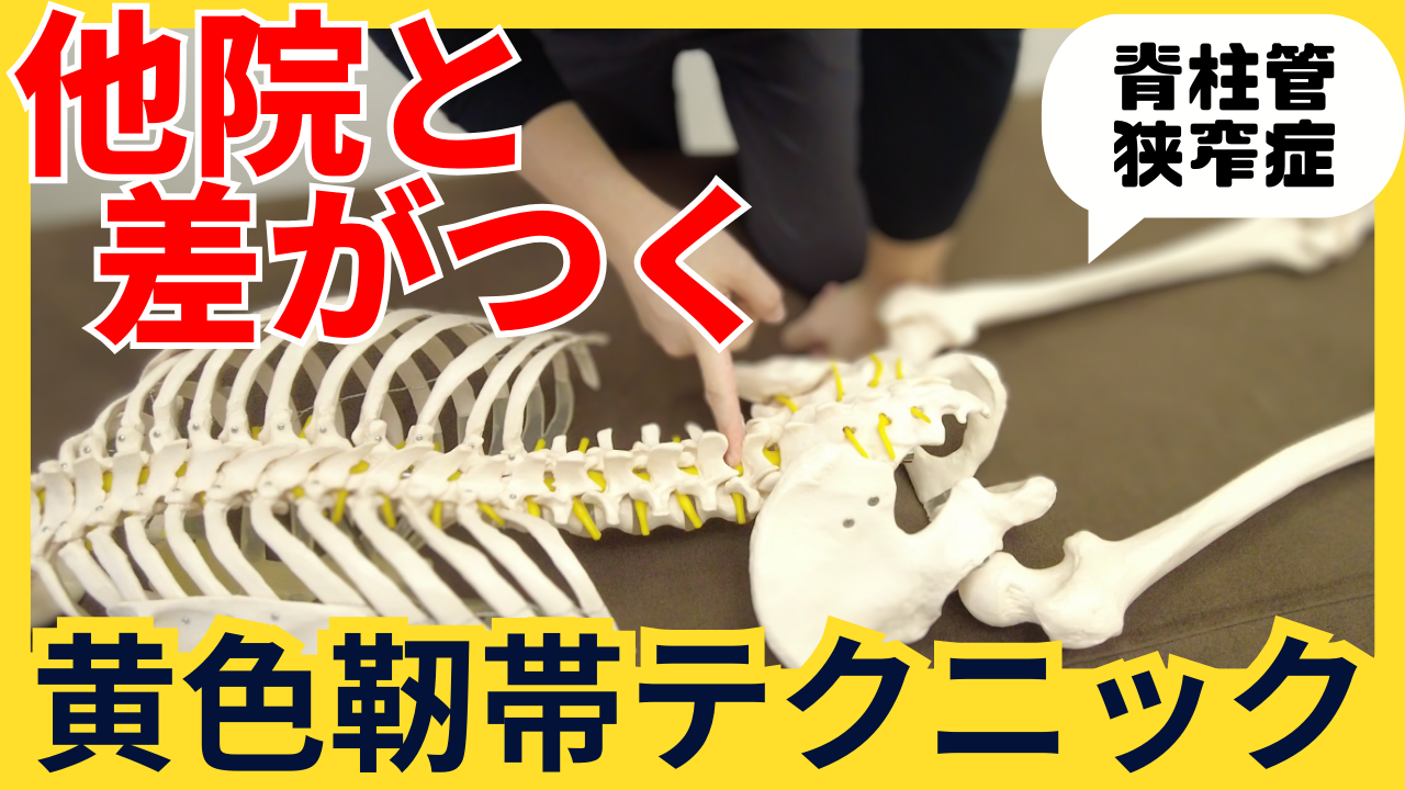 これで他院との差をつけろ!脊柱管狭窄症にやるべき黄色靭帯のリリーステクニック!
