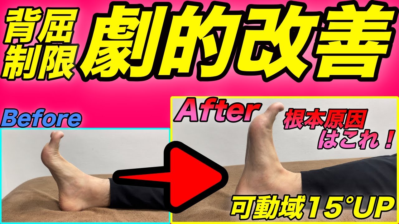 【犯人はこれ】”前編”足関節背屈制限に対する距骨前脂肪帯テクニック