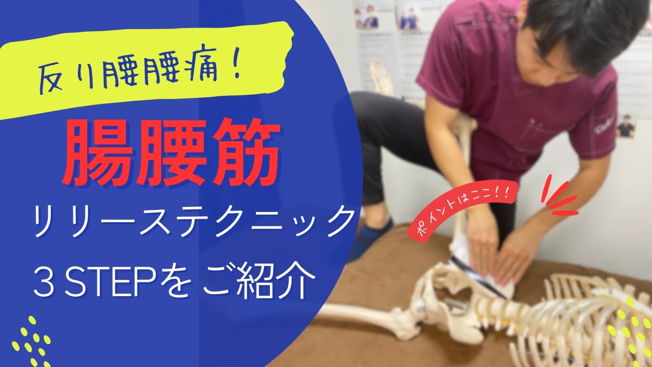【反り腰】見なきゃ損！？腰痛を改善させる腸腰筋リリーステクニックを3stepでご紹介