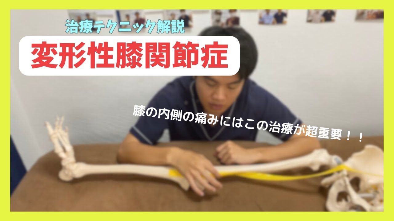 【変形性膝関節症】膝の内側の痛みを改善させるのに超重要な治療テクニックを解説！！
