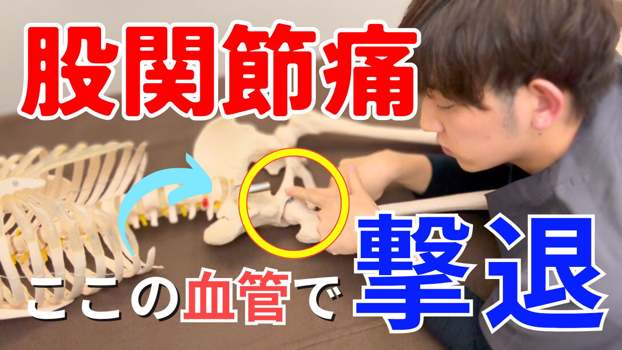 股関節の痛み改善!めっちゃ簡単な大腿回旋動脈のリリーステクニック