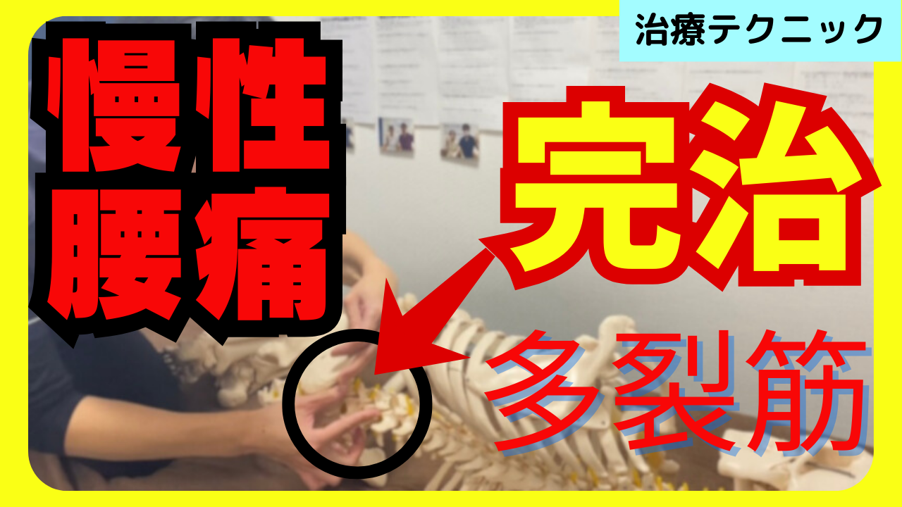 慢性腰痛の原因はここ！ガチガチな多裂筋をゆるゆるにする治療テクニック！！