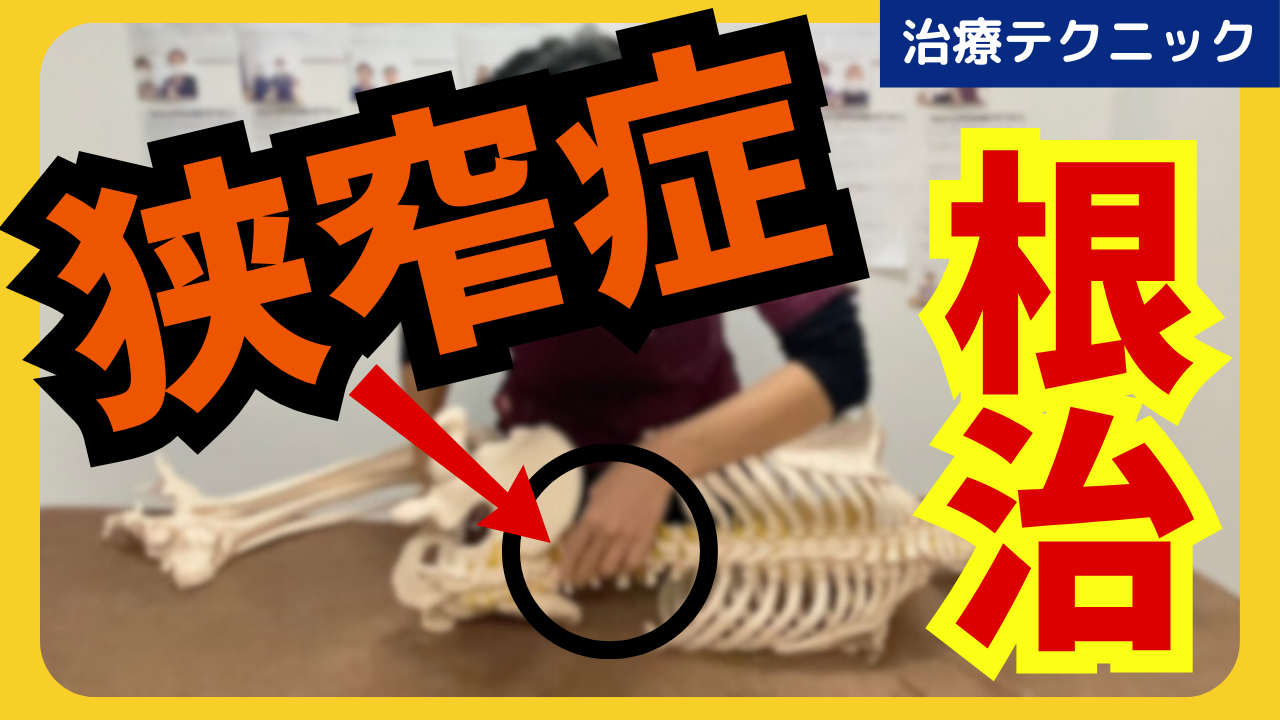 脊柱管狭窄症はこの治療が大事！腰椎の後弯テクニックをご紹介！！