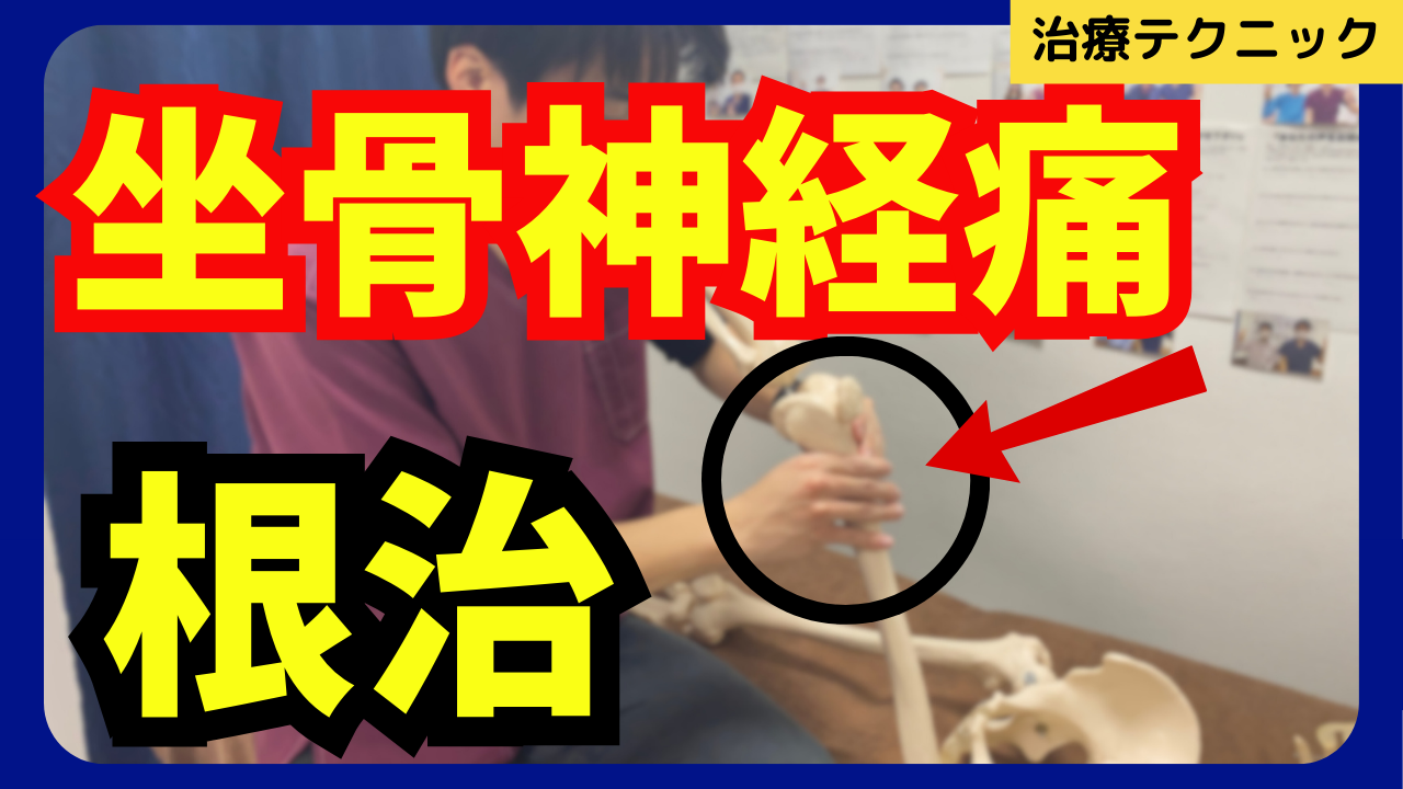 坐骨神経痛はここを見ないと良くならない！？坐骨神経のリリーステクニックをご紹介！！