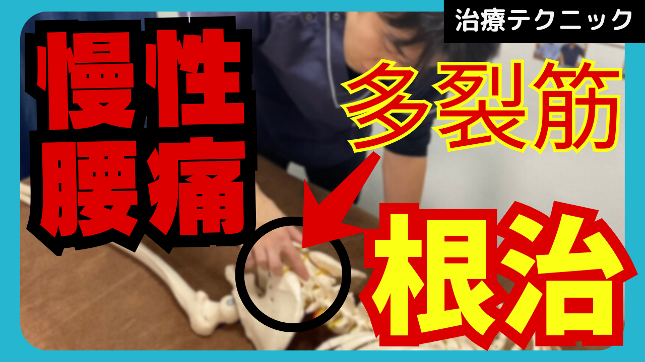 意外と多い！？慢性腰痛を根治させる多裂筋の筋膜リリーステクニック！！