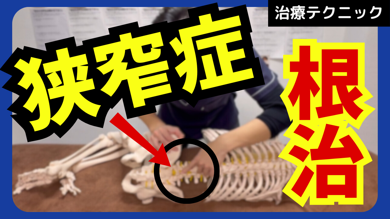 狭窄症はこの治療が超重要！椎間孔の拡大テクニック！！