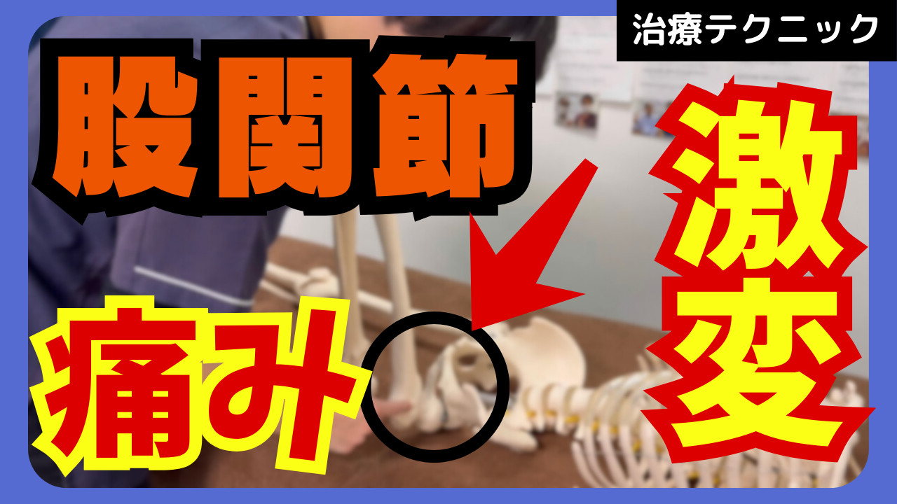 股関節の痛みを激変させる股関節の調整テクニックをご紹介!!