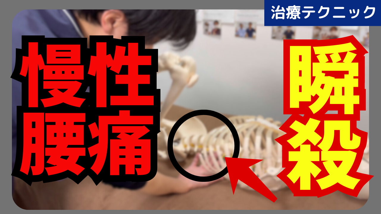 慢性腰痛はこの神経が原因!腸骨下腹神経のリリーステクニックについて解説!!